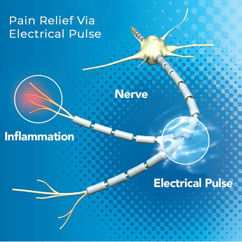 ACCURELIEF™ SINGLE CHANNEL TENS UNIT